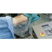 DS-LPC Fluid Collection Pouch with 300cm Long Suction Tube