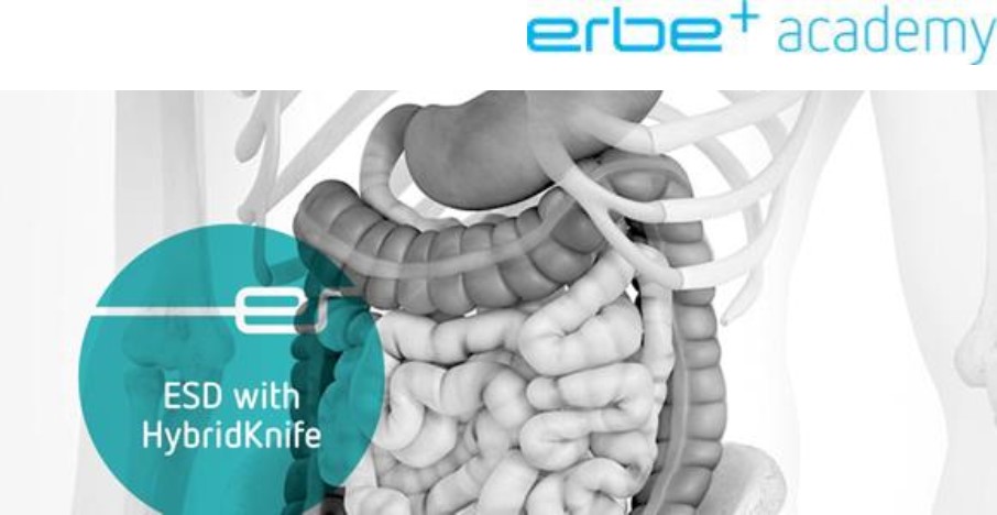 ERBE ESD with HybridKnife®