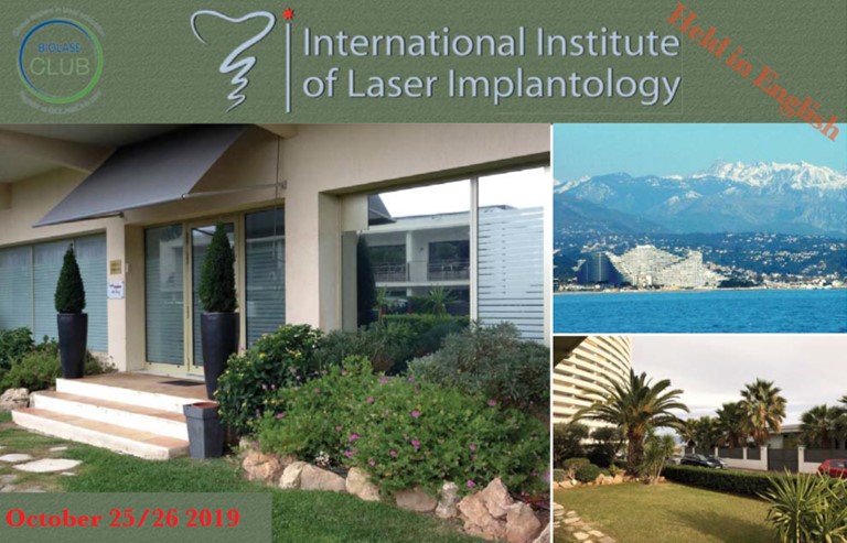 Laser Implant on the French Riviera | France | 2-Days Minimally Laser Implantology Seminar